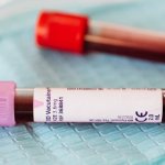 Rendszeres vérvizsgálatok – mikor érdemes elvégezni?